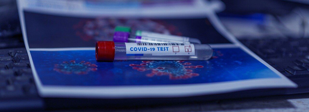 Yπερσύγχρονο όργανο για ανίχνευση του Covid 19 στο Νοσοκομείο Κατερίνης από τον ΕΛΓΟ «Δήμητρα»