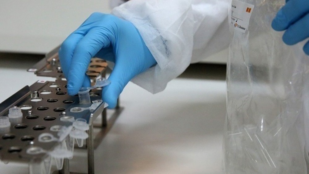 Τα PCR του δημάρχου Συκεών και η σπέκουλα του ΣΥΡΙΖΑ