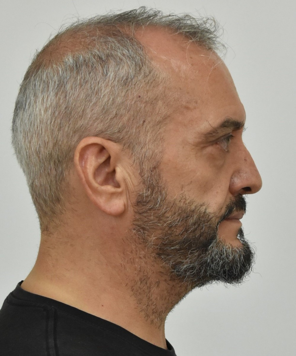 Υπόθεση 12χρονης στον Κολωνό: Ο Μίχος πουλάει την περιουσία του