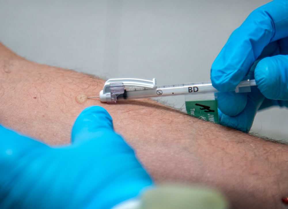 ΕΟΔΥ: 18 κρούσματα mpox τους τελευταίους δύο μήνες - Μέτρα προστασίας