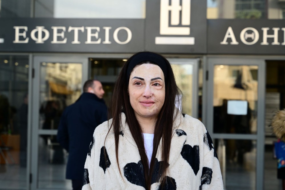 Το συγκινητικό μήνυμα της Ιωάννας Παλιοσπύρου, στη συμπλήρωση 5 ετών από την επίθεση με βιτριόλι
