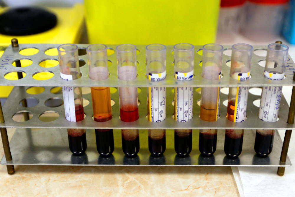 Πανελλαδικές δράσεις ενημέρωσης από τον ΕΟΠΑΕ για την έγκαιρη διάγνωση του HIV