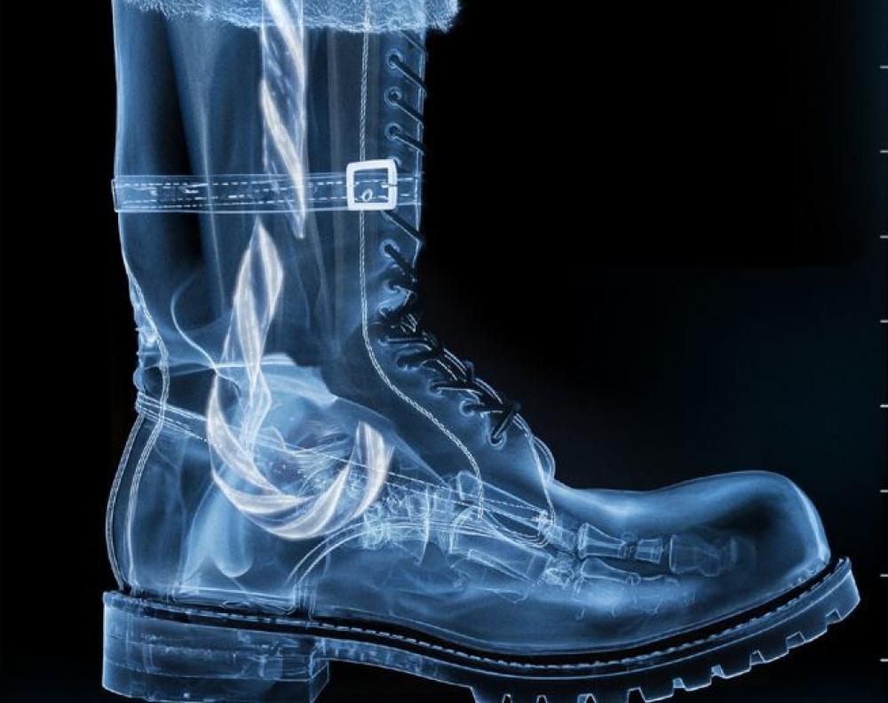 Αβεβαιότητα για τα Χριστούγεννα λόγω τραυματισμού του Αϊ-Βασίλη σε μπασκετικό ατύχημα (video)