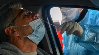 Κορωνοϊός: 2.198 νέα κρούσματα- 400 στις ΜΕΘ και 59 θάνατοι