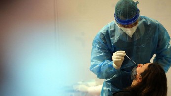 Κορωνοϊός: 1388 κρούσματα, 84 νεκροί και 549 διασωληνωμένοι