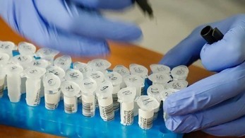 Ρινικό σπρέι κατά του κορωνοϊού κατασκευάζουν Αμερικανοί επιστήμονες