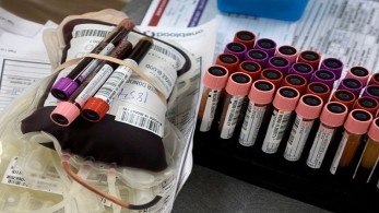 Έως 35% μειώθηκε η συμμετοχή στις αιμοδοσίες: Έκκληση για δωρεά αίματος