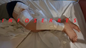 Σέρρες: 9χρονος δέχτηκε επίθεση από σκύλο- Σοκαριστικές εικόνες