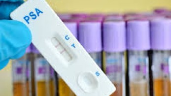 Βασιλακόπουλος: Περιττό το τεστ για κορωνοϊό μετά τον εμβολιασμό