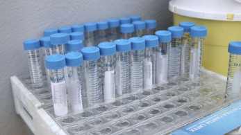Κορωνοϊός: 3493 κρούσματα, 235 διασωληνωμένοι ,24 θάνατοι