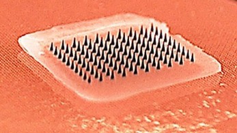 Εμβόλιο κορωνοϊού σε “τσιρότο”: Πιο αποτελεσματικό από τις ενέσεις