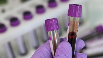 Κορωνοϊός: Σε σοβαρή κατάσταση τρεις από τους 31 ασθενείς