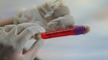 Αποκάλυψη Γιαμαρέλλου: Η Omicron μολύνει 5 φορές περισσότερο από τη Δέλτα