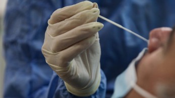 Κορωνοϊός: 3.727 νέα κρούσματα, 14 νεκροί και 133  διασωληνωμένοι