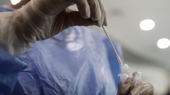 Κορωνοϊός: 2.501 νέα κρούσματα, 10 νεκροί και 119 διασωληνωμένοι