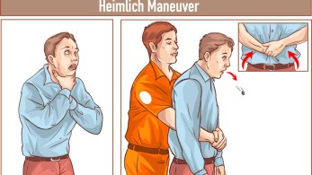Mέθοδος Heimlich: Ποια είναι η λαβή που όλοι πρέπει να γνωρίζουμε και μπορεί να μας σώσει τη ζωή