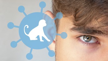 ΕΟΔΥ: Ανδρική υπόθεση η ευλογιά των πιθήκων – Πόσα κρούσματα καταγράφονται