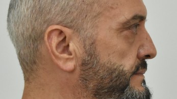  Αναζητούν στον Κεραμεικό τον οίκο ανοχής που πήγαινε ο Μίχος την 12χρονη