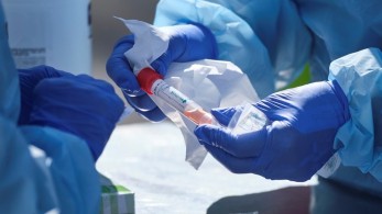 DOCANDU και διαπιστώνεις εάν έχεις προσβληθεί από κορωνοϊό