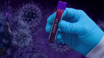 Πανδημία και Διεθνές Δίκαιο: Ποιος πληρώνει για τη ζημιά που προκλήθηκε από τον κορονωϊό;