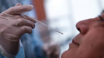 Στρεπτόκοκκος: 89 άνθρωποι νόσησαν και 22 πέθαναν σύμφωνα με τον ΕΟΔΥ