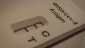 Κορωνοϊός: αυξήθηκαν οι θάνατοι, μειώθηκαν οι νοσηλείες