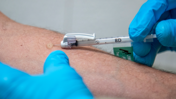 mpox: έξι εμβολιαστικά κέντρα σε όλη την Ελλάδα -Ποιους αφορά