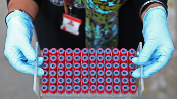 ΕΟΔΥ: άλλα πέντε εμβολιαστικά κέντρα για την mpox – Τι να προσέξουν οι ταξιδιώτες