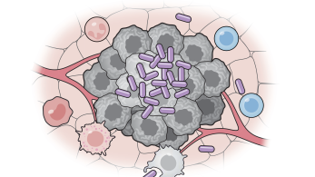 Εμβόλιο με βακτήρια «υπόσχεται» ανοσοθεραπεία για τον καρκίνο
