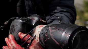 Σύνταγμα: φωτορεπόρτερ τραυματίστηκε στο κεφάλι