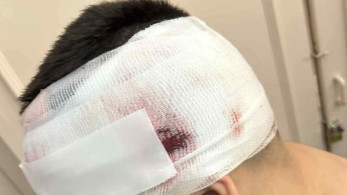 Βία ανηλίκων: στην Τούμπα νέο περιστατικό - Στοιχεία που σοκάρουν Βία ανηλίκων: στην Τούμπα νέο περιστατικό - Στοιχεία που σοκάρουν