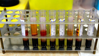 Πανελλαδικές δράσεις ενημέρωσης από τον ΕΟΠΑΕ για την έγκαιρη διάγνωση του HIV