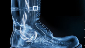 Αβεβαιότητα για τα Χριστούγεννα λόγω τραυματισμού του Αϊ-Βασίλη σε μπασκετικό ατύχημα (video)