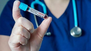 Σκόπελος: Θετική στον κορωνοϊό 23χρονη τουρίστρια
