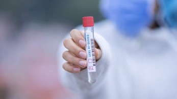 Κορωνοϊός: Έρχονται νέα, ταχύτερα και φθηνότερα, μοριακά τεστ σάλιου