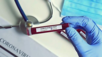 Τον διέσυραν χωρίς λόγο – Δεν ήταν σε καραντίνα ο 23χρονος στην Κατερίνη